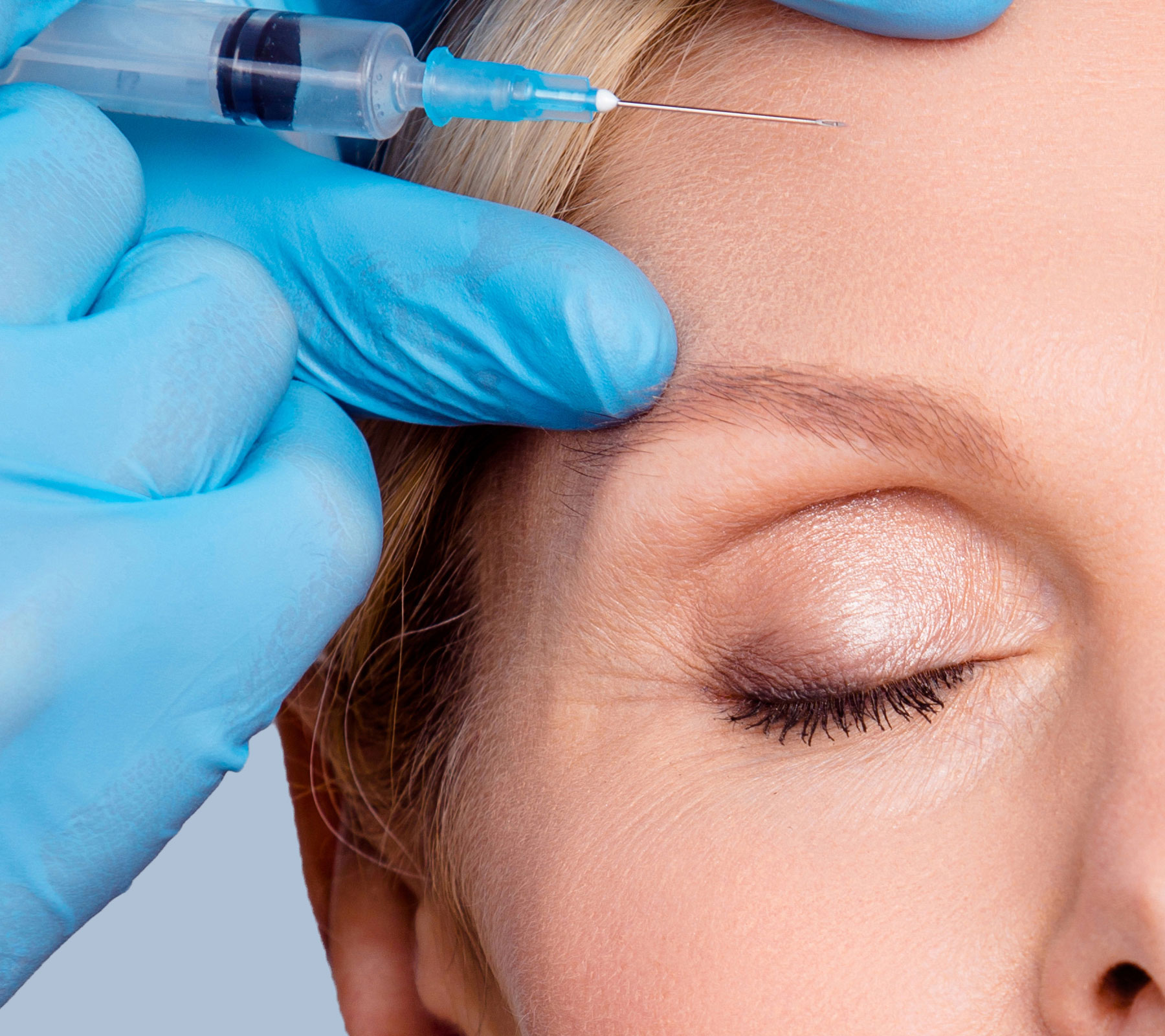 Upper Forehead Botox