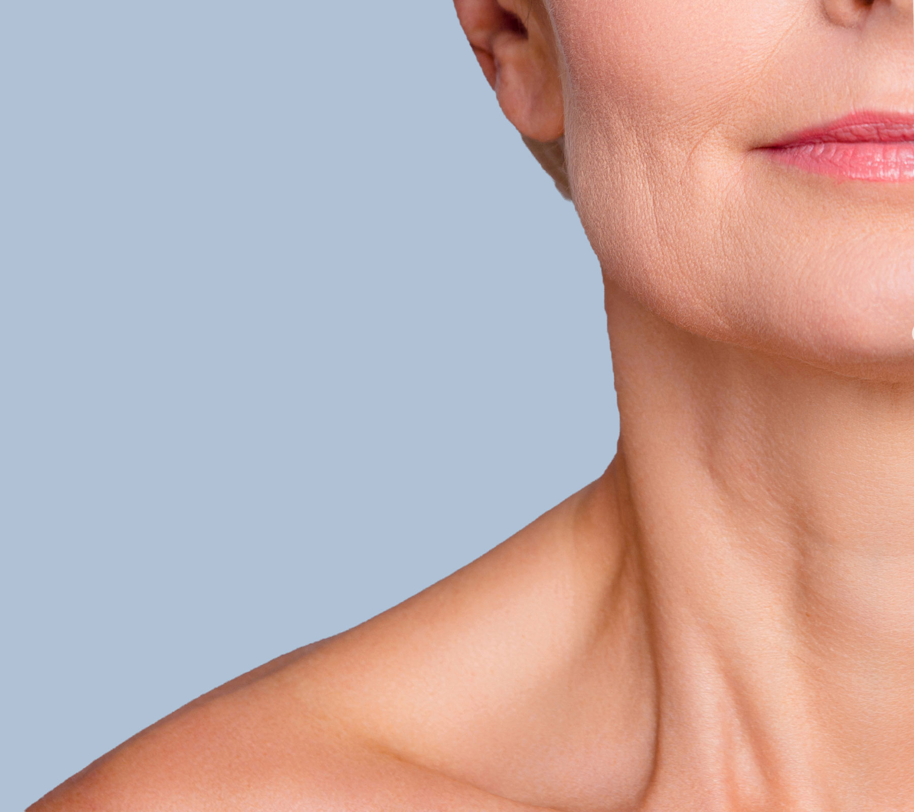 Botox for Platysmal Bands
